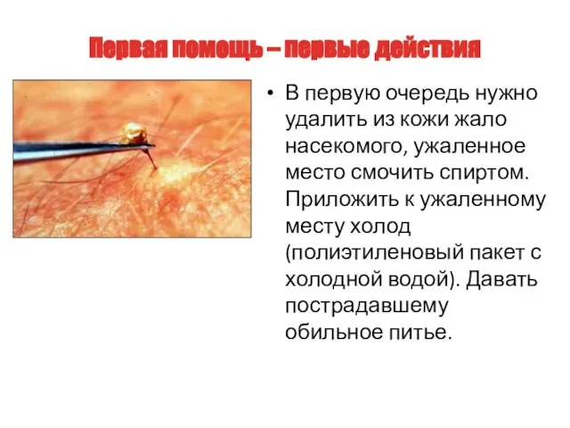 В первую очередь нужно удалить из кожи жало насекомого, ужаленное место смочить