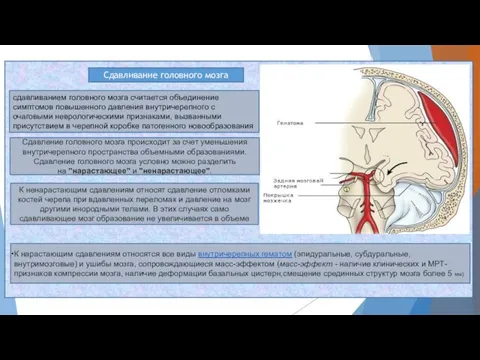 Сдавливание головного мозга сдавливанием головного мозга считается объединение симптомов повышенного давления внутричерепного