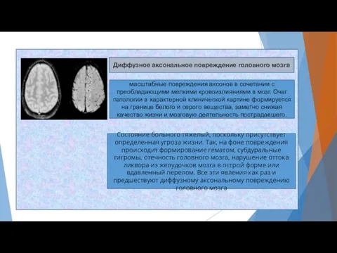 Диффузное аксональное повреждение головного мозга масштабные повреждения аксонов в сочетании с преобладающими