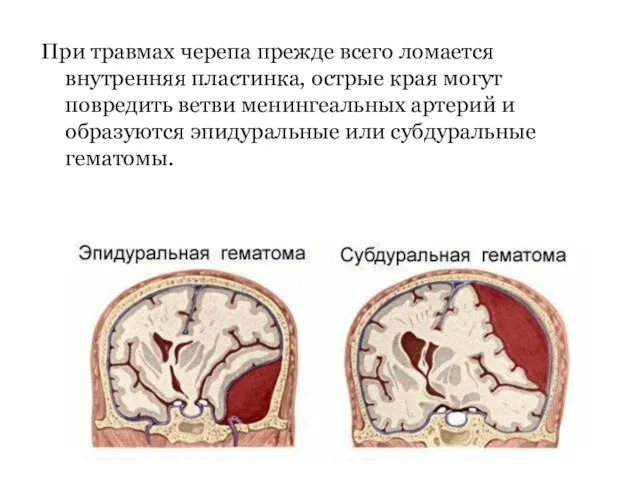 При травмах черепа прежде всего ломается внутренняя пластинка, острые края могут повредить