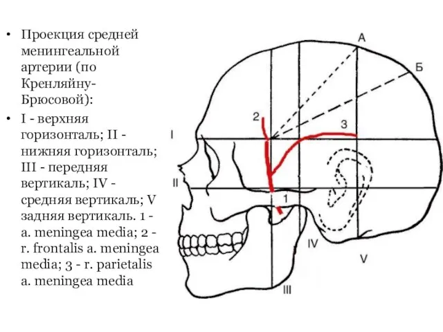 Проекция средней менингеальной артерии (по Кренляйну- Брюсовой): I - верхняя горизонталь; II