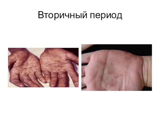 Вторичный период