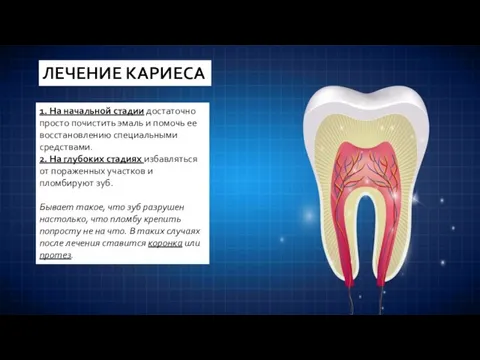 ЛЕЧЕНИЕ КАРИЕСА 1. На начальной стадии достаточно просто почистить эмаль и помочь