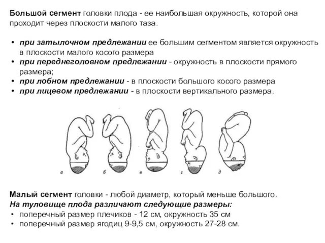 Большой сегмент головки плода - ее наибольшая окружность, которой она проходит через