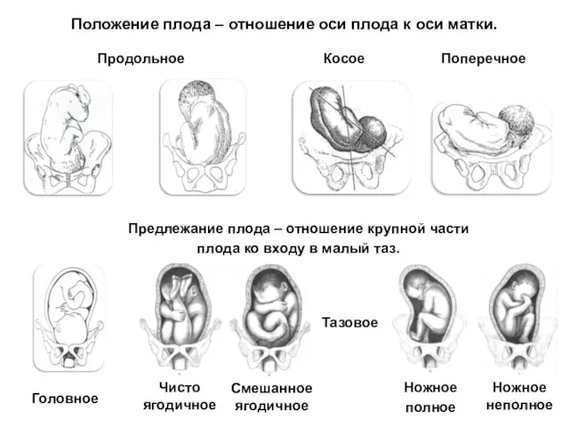 Положение плода – отношение оси плода к оси матки. Предлежание плода –