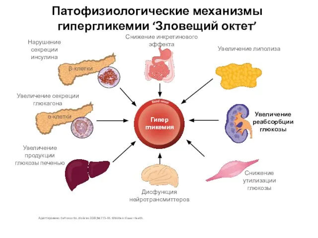 Патофизиологические механизмы гипергликемии ‘Зловещий октет’ Адаптировано: DeFronzo RA. Diabetes 2009;58:773–95. ©Wolters Kluwer