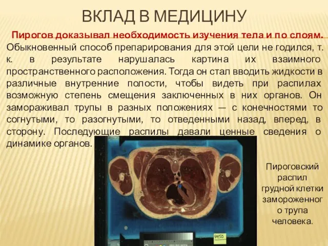 ВКЛАД В МЕДИЦИНУ Пирогов доказывал необходимость изучения тела и по слоям. Обыкновенный