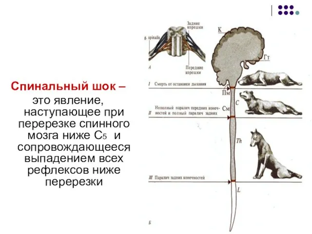 Спинальный шок – это явление, наступающее при перерезке спинного мозга ниже С5