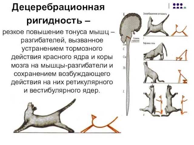 Децеребрационная ригидность – резкое повышение тонуса мышц – разгибателей, вызванное устранением тормозного