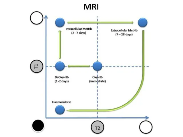 MRI