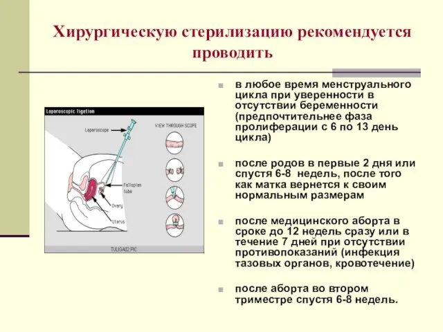 Хирургическую стерилизацию рекомендуется проводить в любое время менструального цикла при уверенности в