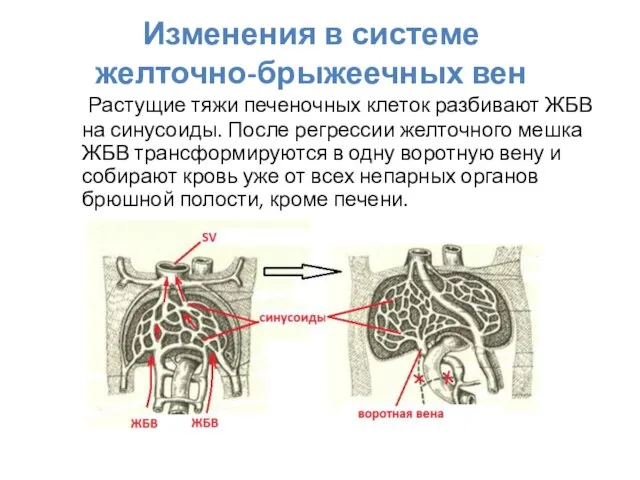 Изменения в системе желточно-брыжеечных вен Растущие тяжи печеночных клеток разбивают ЖБВ на