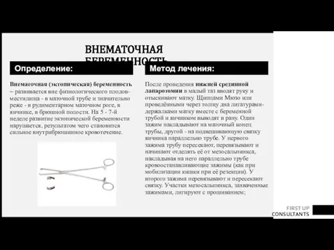 Определение: Внематочная (эктопическая) беременность – развивается вне физиологического плодов-местилища - в маточной