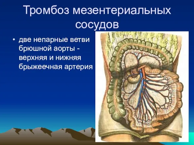 Тромбоз мезентериальных сосудов две непарные ветви брюшной аорты - верхняя и нижняя брыжеечная артерия