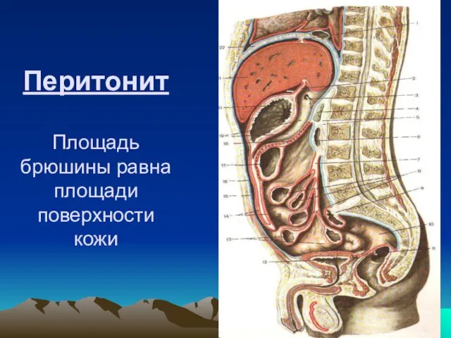 Перитонит Площадь брюшины равна площади поверхности кожи