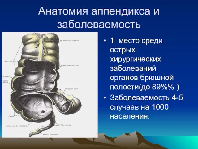 Анатомия аппендикса и заболеваемость 1 место среди острых хирургических заболеваний органов брюшной