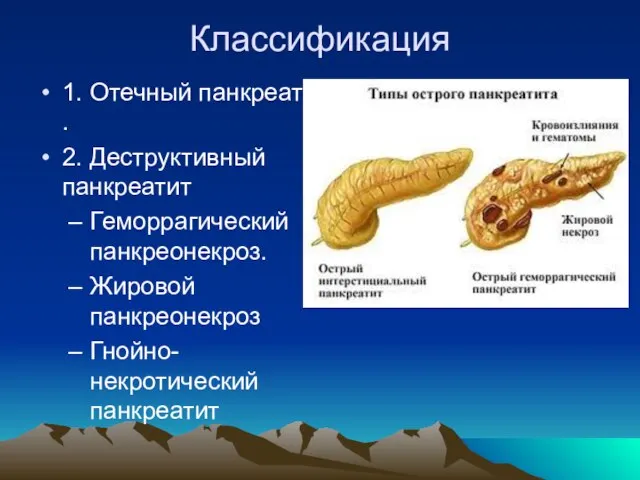 Классификация 1. Отечный панкреатит . 2. Деструктивный панкреатит Геморрагический панкреонекроз. Жировой панкреонекроз Гнойно-некротический панкреатит