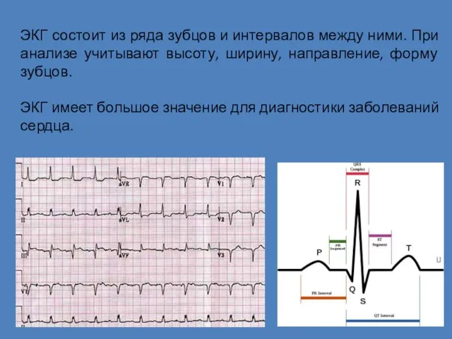 ЭКГ состоит из ряда зубцов и интервалов между ними. При анализе учитывают