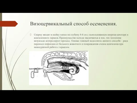 Визоцервикальный способ осеменения. Сперму вводят в шейку матки на глубину 4-6 см