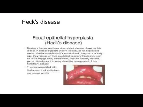 Heck’s disease