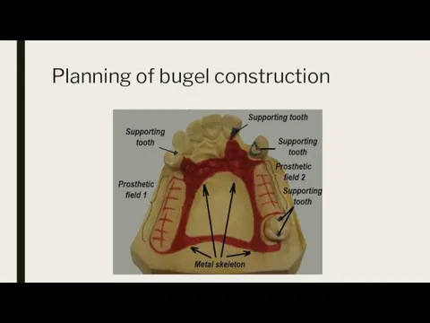 Planning of bugel construction