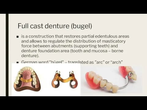 Full cast denture (bugel) is a construction that restores partial edentulous areas