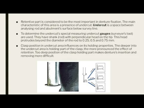 Retentive part is considered to be the most important in denture fixation.