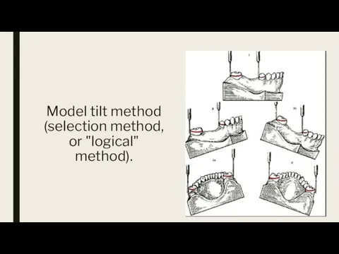 Model tilt method (selection method, or "logical" method).