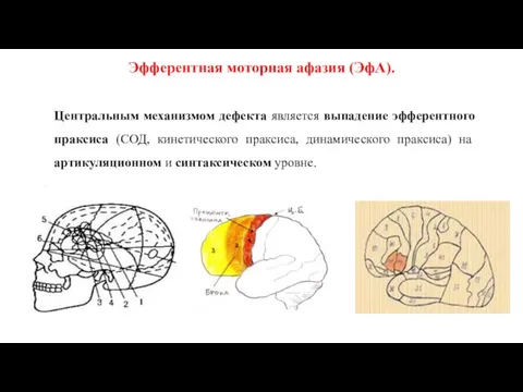 Эфферентная моторная афазия (ЭфА). Центральным механизмом дефекта является выпадение эфферентного праксиса (СОД,