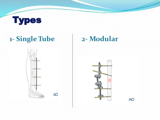 Types 1- Single Tube 2- Modular