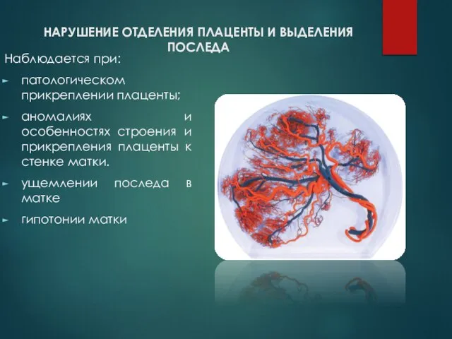 НАРУШЕНИЕ ОТДЕЛЕНИЯ ПЛАЦЕНТЫ И ВЫДЕЛЕНИЯ ПОСЛЕДА Наблюдается при: патологическом прикреплении плаценты; аномалиях