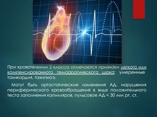 При кровотечении 2 класса отмечаются признаки легкого или компенсированного геморрагического шока: умеренные