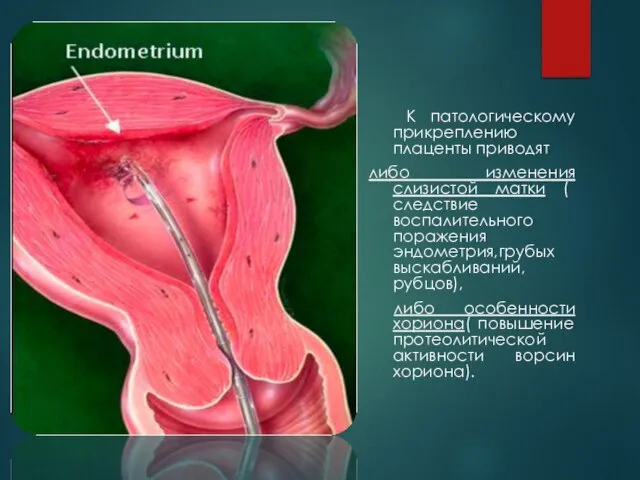 К патологическому прикреплению плаценты приводят либо изменения слизистой матки ( следствие воспалительного