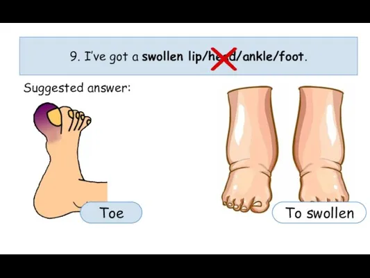 9. I’ve got a swollen lip/head/ankle/foot. Suggested answer: To swollen Toe