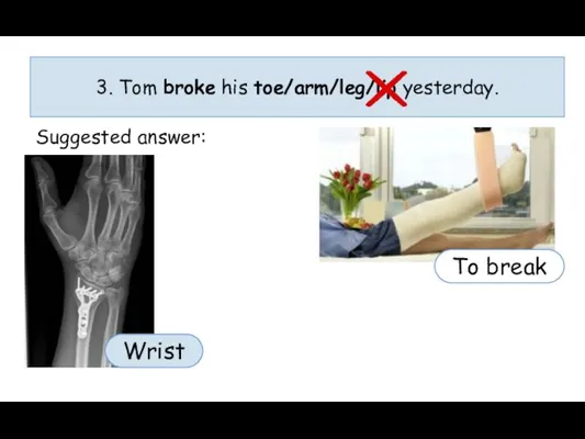 3. Tom broke his toe/arm/leg/lip yesterday. Suggested answer: To break Wrist