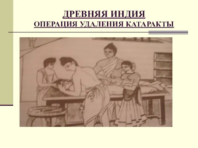 ДРЕВНЯЯ ИНДИЯ ОПЕРАЦИЯ УДАЛЕНИЯ КАТАРАКТЫ