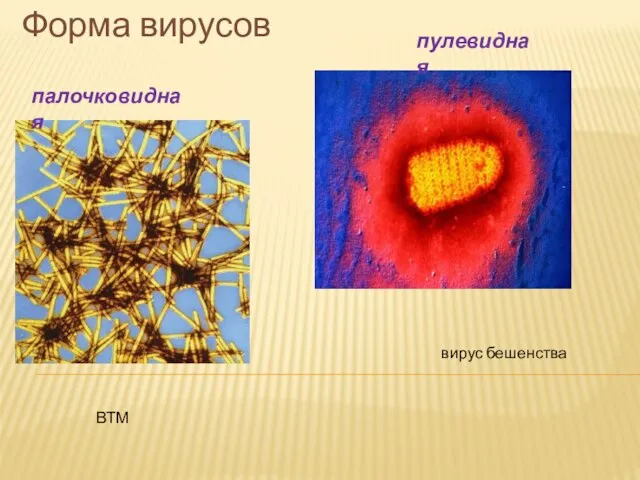 Форма вирусов палочковидная пулевидная ВТМ вирус бешенства