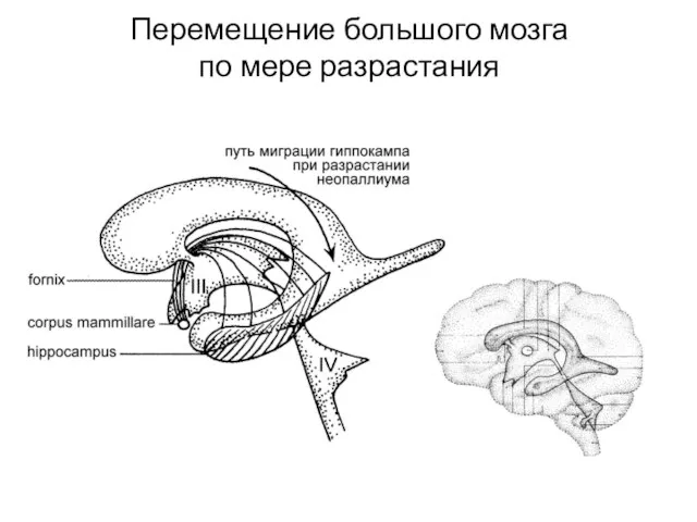 Перемещение большого мозга по мере разрастания