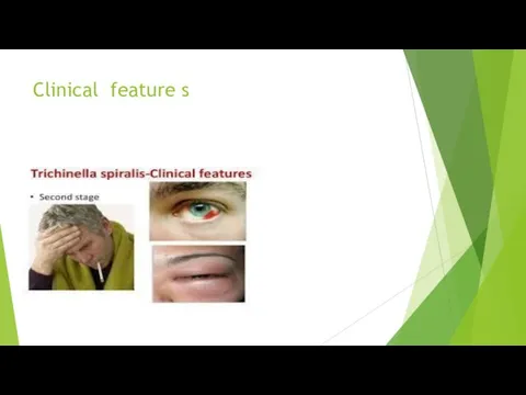 Clinical feature s