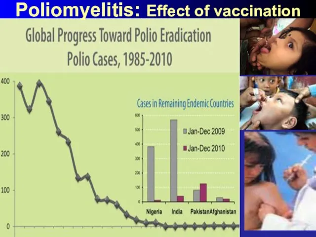 Poliomyelitis: Effect of vaccination