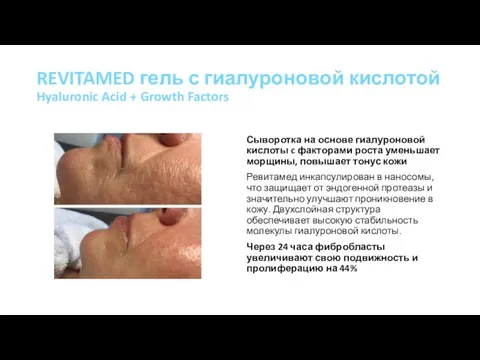 REVITAMED гель с гиалуроновой кислотой Hyaluronic Acid + Growth Factors Сыворотка на