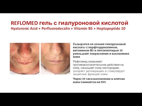 REFLOMED гель с гиалуроновой кислотой Hyaluronic Acid + Perfluorodecalin + Vitamin B5