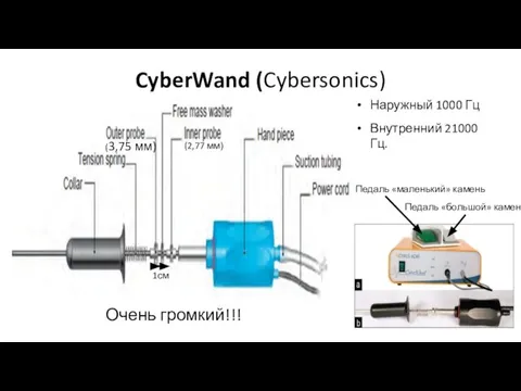 CyberWand (Cybersonics) (2,77 мм) (3,75 мм) 1см Внутренний 21000 Гц. Наружный 1000