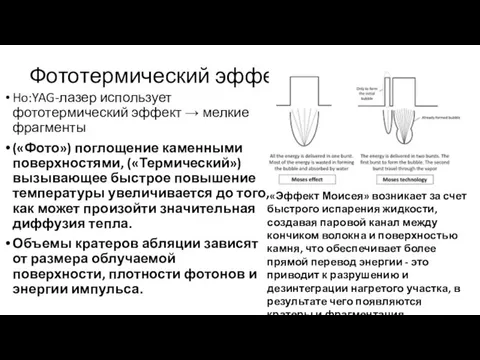 Фототермический эффект Ho:YAG-лазер использует фототермический эффект → мелкие фрагменты («Фото») поглощение каменными