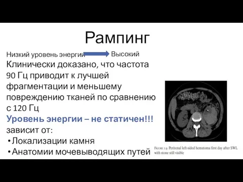 Рампинг Низкий уровень энергии Высокий Клинически доказано, что частота 90 Гц приводит