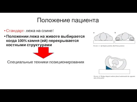 Положение пациента Стандарт- лежа на спине! Положении лежа на животе выбирается когда