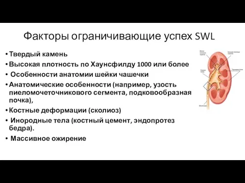 Факторы ограничивающие успех SWL Твердый камень Высокая плотность по Хаунсфилду 1000 или