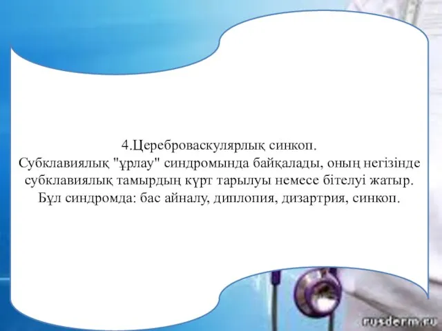 4.Цереброваскулярлық синкоп. Субклавиялық "ұрлау" синдромында байқалады, оның негізінде субклавиялық тамырдың күрт тарылуы