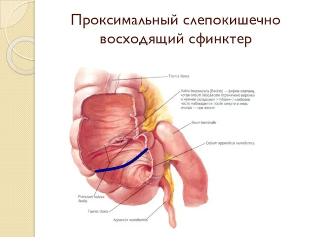 Проксимальный слепокишечно­восходящий сфинктер