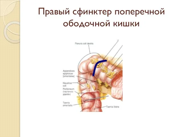 Правый сфинктер поперечной ободочной кишки